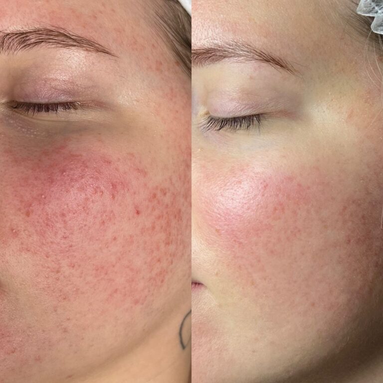 63f906afd9e66a5bee2e9e37fe371c49