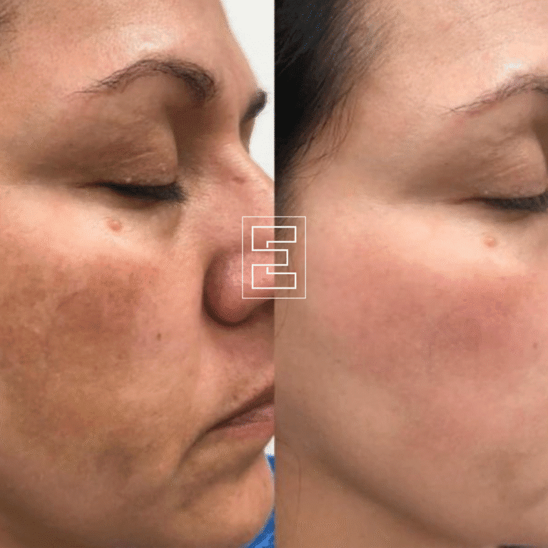 Facial foto's website