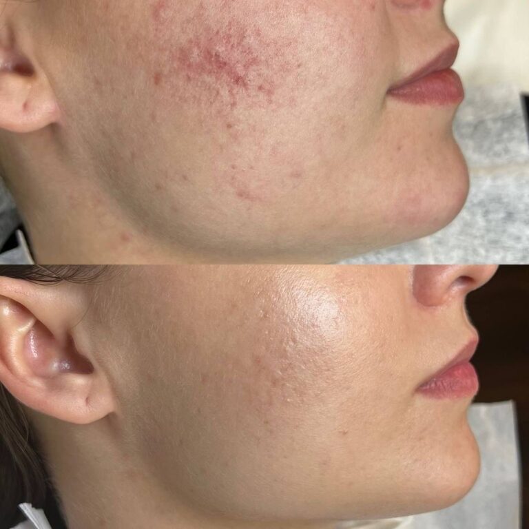 fc77d6468295906b384a101f1f9ea64a