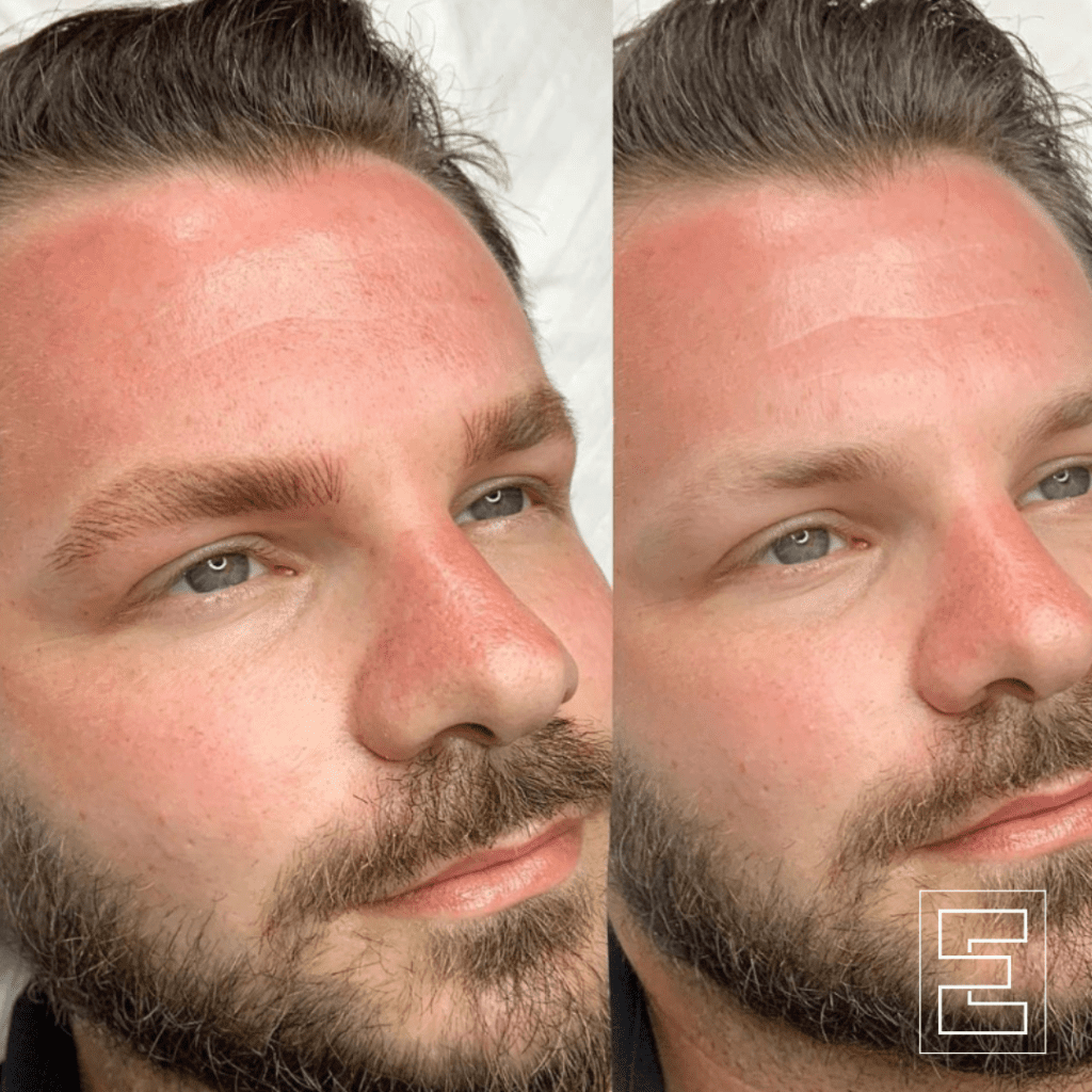 Hairstroke/Nano brows